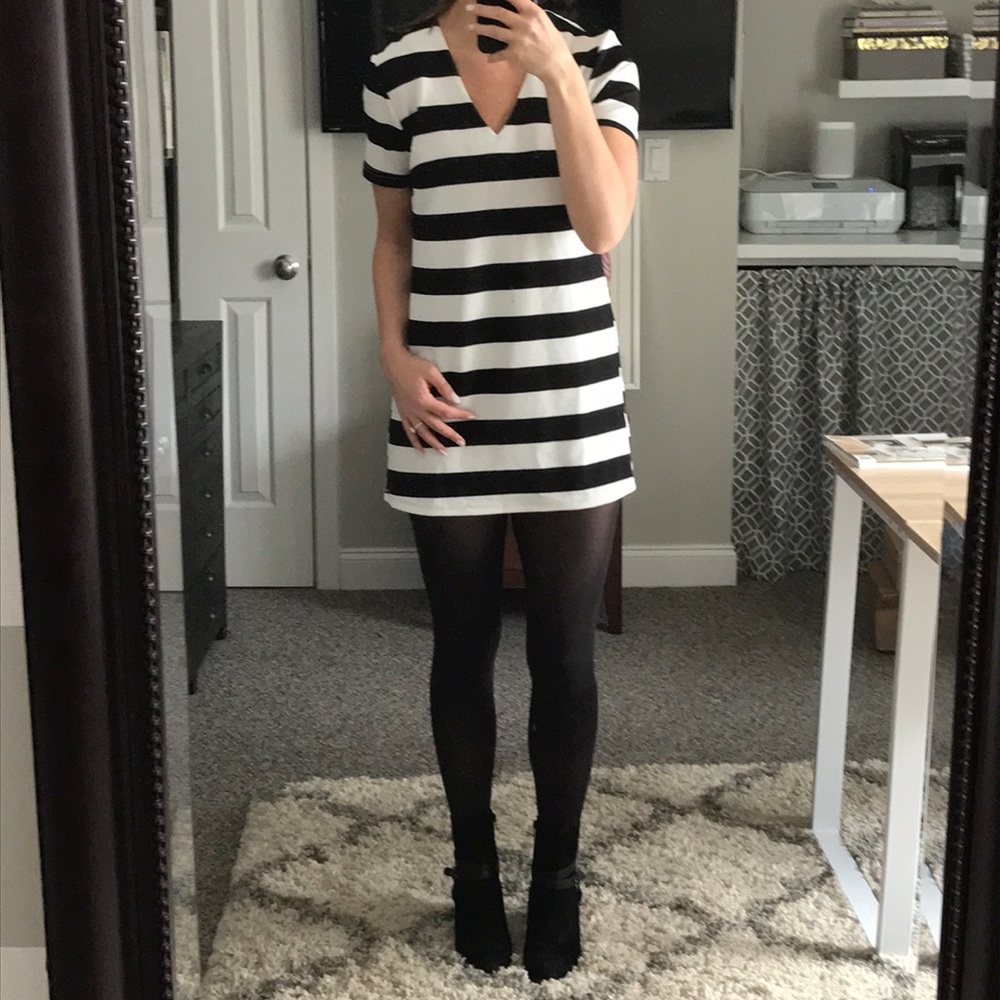 Black and White Striped Tunic/Dress